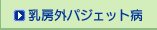 [OpWFbga