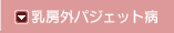[OpWFbga