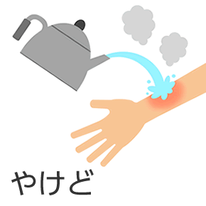 やけど