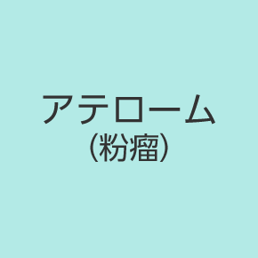 アテローム（粉瘤）