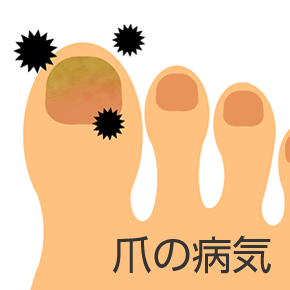 爪の病気