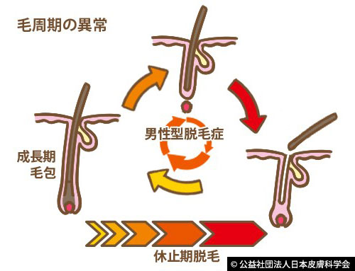 毛周期の異常