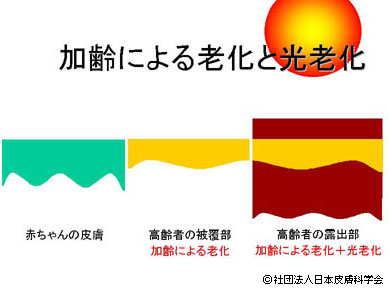 加齢による老化と光老化