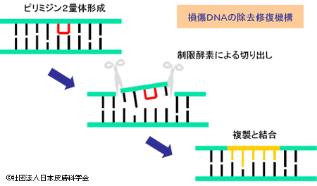 損傷DNAの除去修復機構