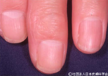 治療開始3年後