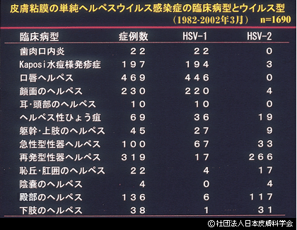 表1　単純ヘルペスの臨床病型とウイルス型