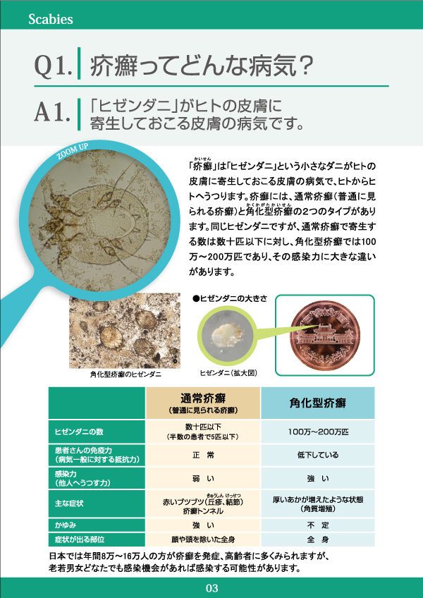 疥癬 かいせん Q1 皮膚科q A 公益社団法人日本皮膚科学会