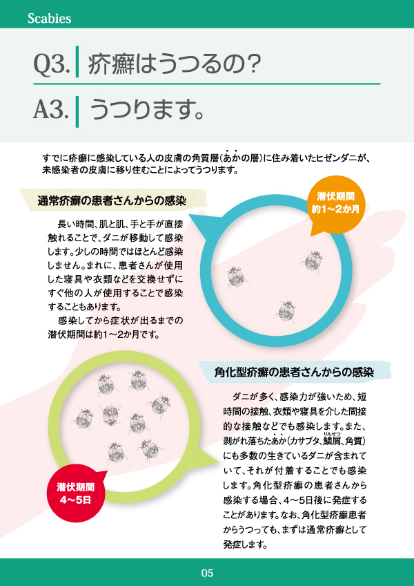 疥癬はうつるの？