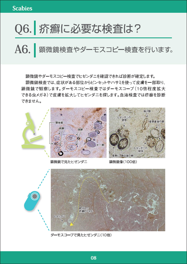 疥癬に必要な検査は？