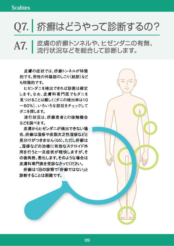 疥癬はどうやって診断するの？
