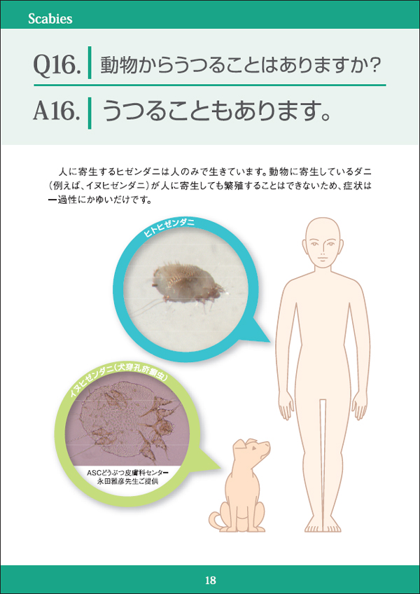 疥癬 かいせん Q16 皮膚科q A 公益社団法人日本皮膚科学会